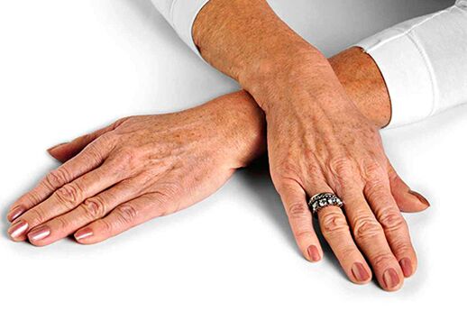 جلد اليد مع التغيرات المرتبطة بالعمر التي تتطلب استخدام تقنيات التجديد